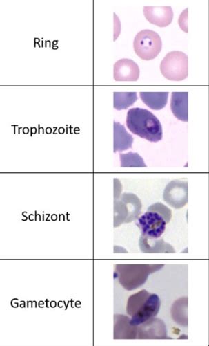 Malaria And Babesiosis Flashcards Quizlet