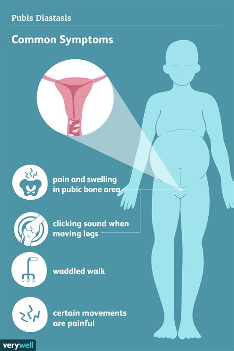 Pubic bone in pregnancy. Pubic bone pain in pregnancy - Healthy Food