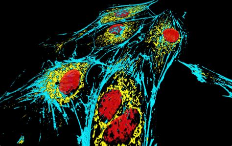 Melanoma Cells