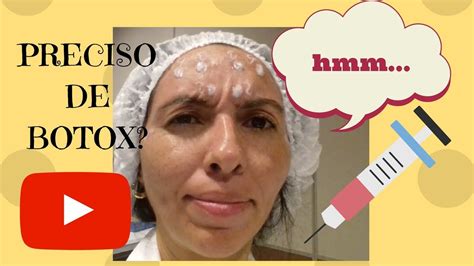 Botox E Preenchimento Curso 2 Youtube