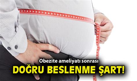 Obezite ameliyatı sonrası doğru beslenme şart Sağlık Öncü Şehir