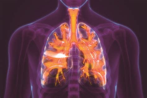 Airway Clearance Therapy And Non Cf Bronchiectasis Rt