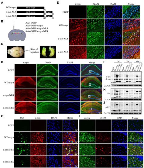 Frontiers Nuclear Localization Of Alpha Synuclein Affects The