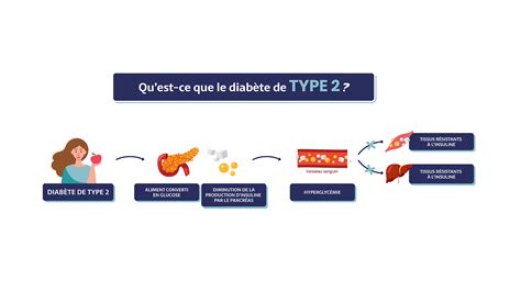 Le diabète résumé en trois schémas Pep2Dia