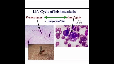 Haemoflagellatesleishmania And Trypanosoma Youtube