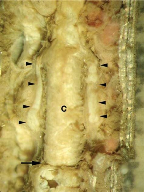 Dorsal view of crop caeca (triangles) and crop/intestine sphincter ...