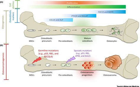 Osteosarcoma Molecular Pathogenesis And Ipsc Modeling Trends In