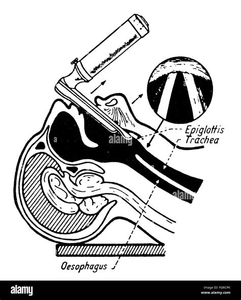 Medicine Instruments Equipment Laryngoscope Oral Intubation