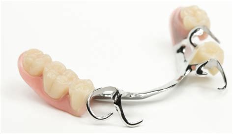 Dentures In Lichfield Asquith Dental