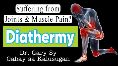 Diathermy Types Benefits And Risks Dr Gary Sy Youtube