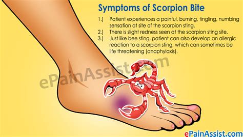 Scorpion Bite Symptoms Home Remedies First Aid Treatment