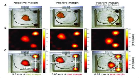 Lumpectomy Specimen Phantoms Mpi Signal From Small Bore Scanner And