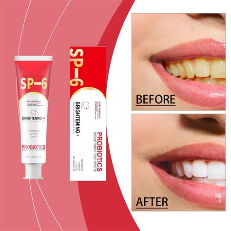 Probiotic Toothpaste For Teeth Cleaning And Hygiene Reducing Stains Refreshing And Caring For