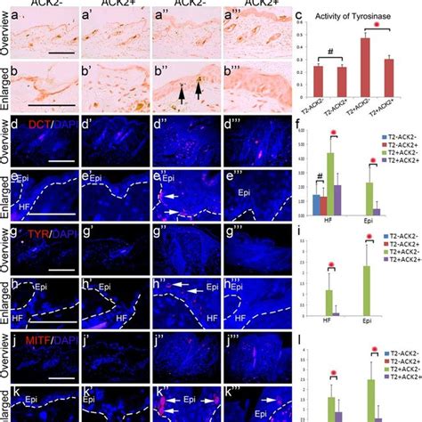 Summary Of The TPA Induced Epidermal Pigmentation Process TPA