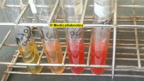 Principle of Methyl Red Test Archives - Medical Notes