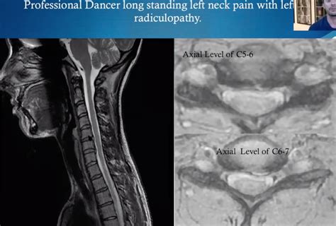 Module 4 Understanding Spinal Mri Pathology Go2imaging