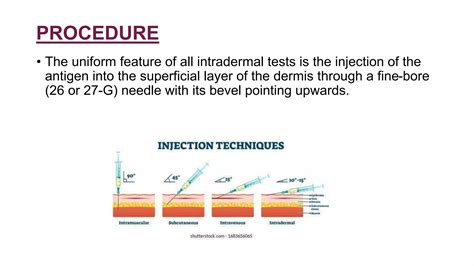 Intradermal Tests Pptx