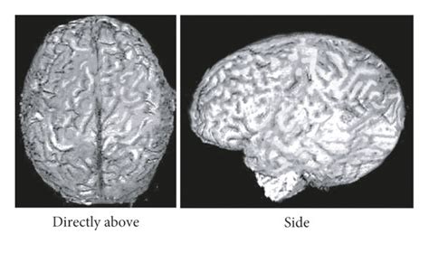 Display Of The Three Dimensional Reconstruction Effect Download Scientific Diagram