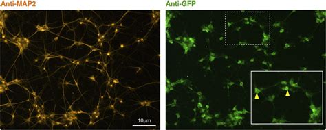 Example Of Neuronal Culture At 4 Weeks Of Differentiation After