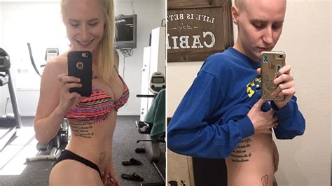 Naked Girls From Social Networks Cancer Photos Porn Photo