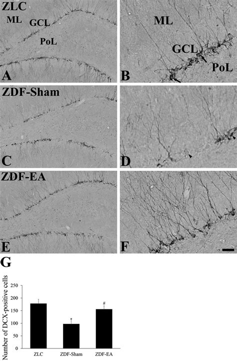 Immunohistochemistry For Dcx In The Dentate Gyrus In Zlc A And B