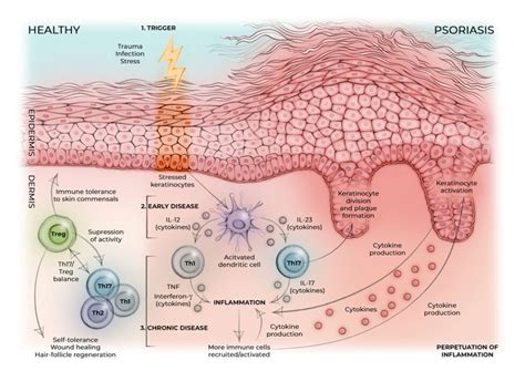 psoriasis work canadian psoriasis network