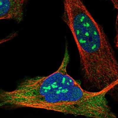 Exosome component 10 Antibody (NBP1-82447): Novus Biologicals