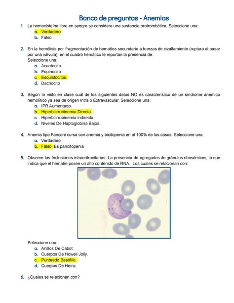 Banco De Preguntas Anemias Seleccione Una A Verdadero B Falso En