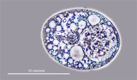 Candida Albicans Microscope Slide