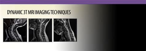 Portland 3t Mri Always Demand 3t Mri For Your Imaging Needs