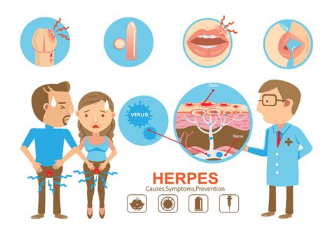 Como Aliviar Os Sintomas Da Herpes Genital Braincp