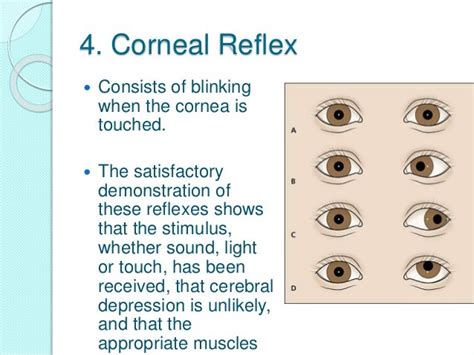 Corneal Reflexes