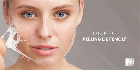 O que é o Peeling de Fenol Núcleo Dome