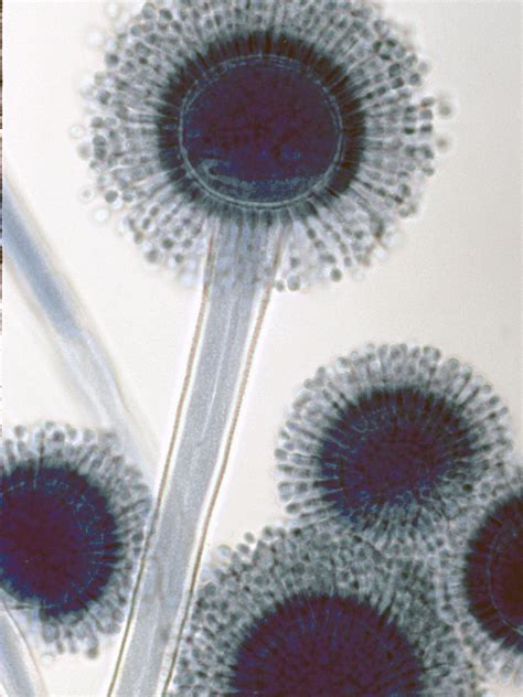 Aspergillus - uniseriate phialides