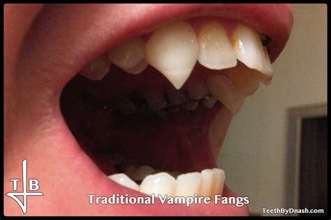 Traditional Vampire Teeth By Dnash