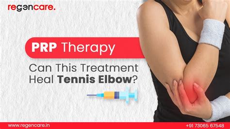 Can Prp Therapy Heal Tennis Elbow Best Prp Treatment For Tennis Elbow