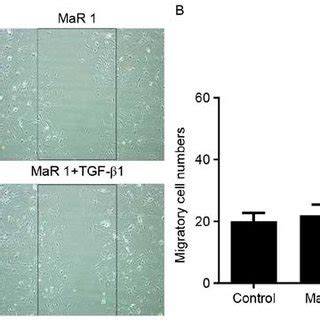 MaR 1 inhibits TGFβ1induced Smad and ERK phosphorylation in MRC5