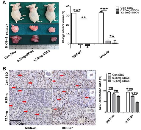 Modification Of Mcl Alternative Splicing Induces Apoptosis And