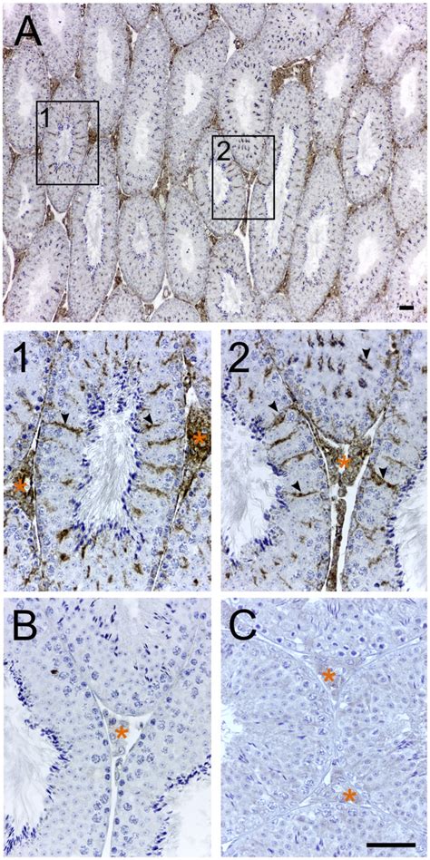 Immunohistochemical Localization Of TSPO In Testes From An 8 Week Old