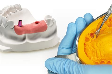 Clasificacion De Los Materiales De Impresion Dental Images And Photos