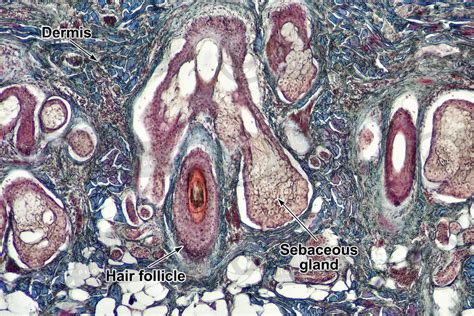 Man Sebaceous Gland Vertical Section X Sebaceous Gland Mammals