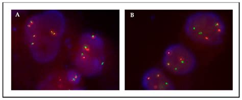 Jmp Free Full Text Fluorescence In Situ Hybridization Fish For