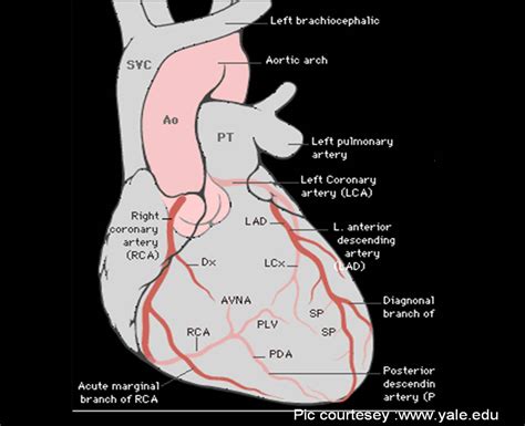 Atrioventricular Groove Drsvenkatesan Md