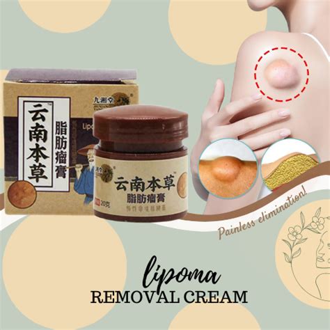 Organic G Lipoma Removal Cream Effective Treat Tumor Skin Swelling