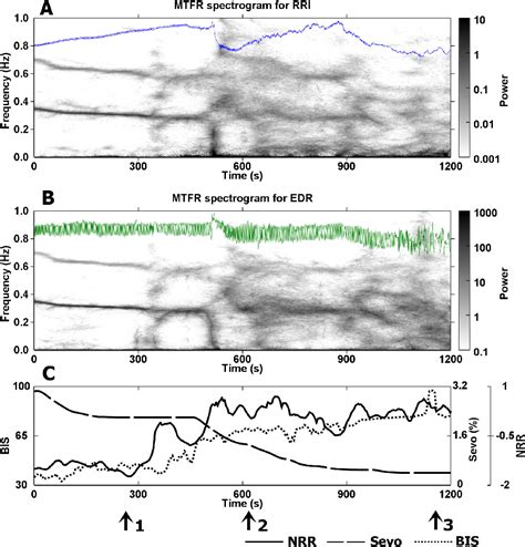 Figure 6 3 From The Modeling And Quantification Of Rhythmic To Non