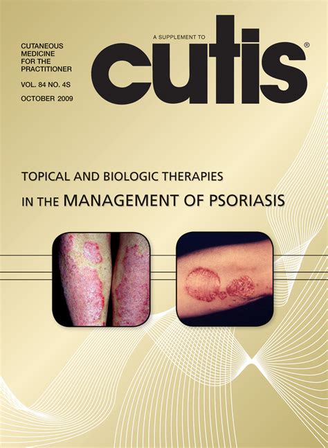 Topical And Biologic Therapies In The Management Of Psoriasis Mdedge