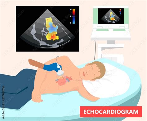 Cath Lab Atrial Septal Defect Tetralogy Of Fallot Patent Foramen Ovale