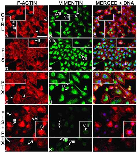 The Individual And Combined Effect Of Fisetin And Paclitaxel On The