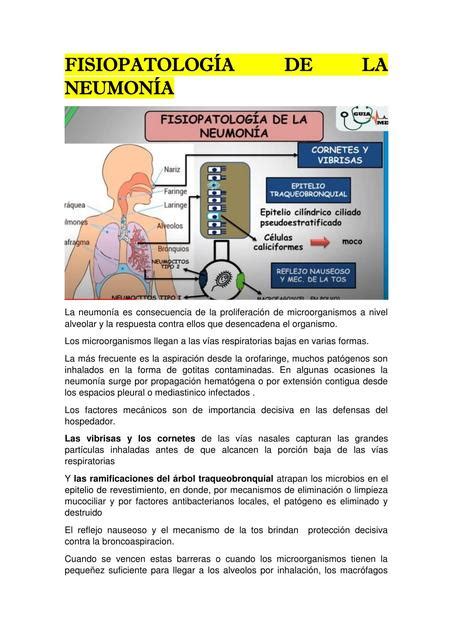 Neumonía Fisiopatología Neumonía Udocz