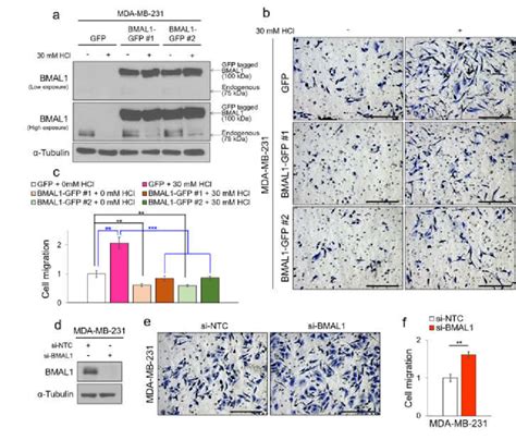 Tumor Acidosis Mediated Decrease Of Bmal1 Expression Promotes Download Scientific Diagram